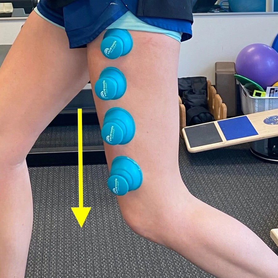 Riptide Sport Cupping Set